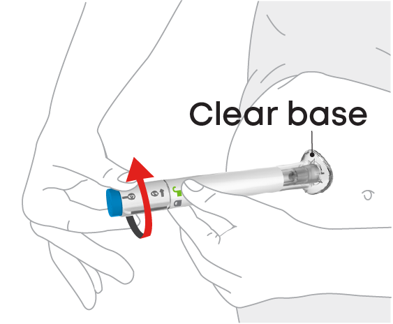 Visual of how to place and unlock an Omvoh subcutaneous injection pen on the injection site